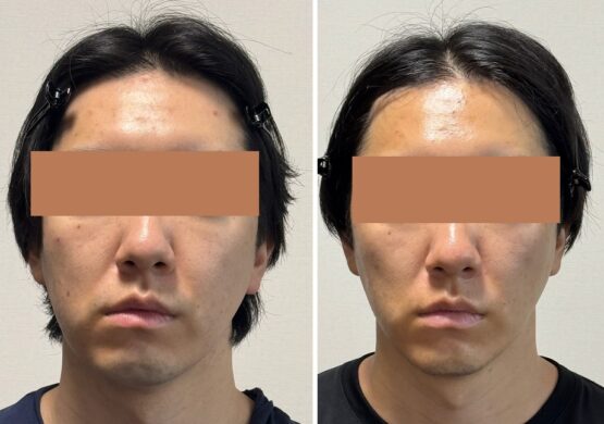 顔ドック口コミ　非対称が治った